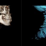 大阪府高槻市ご開業きたむら歯科医院 北村先生のご厚意による写真